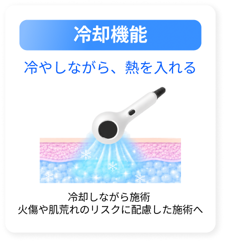 冷却
